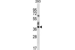 Western Blotting (WB) image for anti-Olfactory Receptor, Family 9, Subfamily K, Member 2 (OR9K2) antibody (ABIN2996627) (OR9K2 Antikörper)