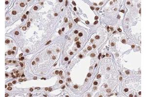 ABIN6267014 at 1/100 staining human kidney tissue sections by IHC-P.