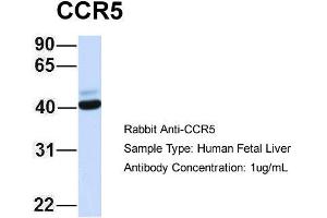 Host: Rabbit Target Name: CCR5 Sample Type: Human Fetal Liver Antibody Dilution: 1. (CCR5 Antikörper  (Middle Region))