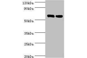 Western blot All lanes: TROVE2 antibody at 2 μg/mL Lane 1: Hela whole cell lysate Lane 2: 293T whole cell lysate Secondary Goat polyclonal to rabbit IgG at 1/10000 dilution Predicted band size: 61, 24, 59, 60 kDa Observed band size: 61 kDa (TROVE2 Antikörper  (AA 3-535))