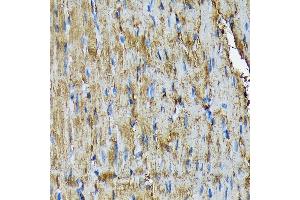 Immunohistochemistry of paraffin-embedded rat heart using HSP20/HSPB6 Rabbit mAb (ABIN7267592) at dilution of 1:100 (40x lens). (HSPB6 Antikörper)