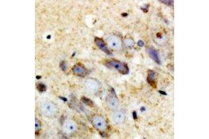 Immunohistochemical analysis of Complement C1QA staining in mouse brain formalin fixed paraffin embedded tissue section. (C1QA Antikörper)