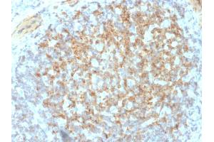 Formalin-fixed, paraffin-embedded human Tonsil stained with CD61 Mouse Monoclonal Antibody (ITGB3/2145).