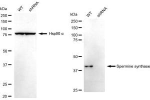 Western blotting analysis using Spermine synthase antibody (ABIN7800420).