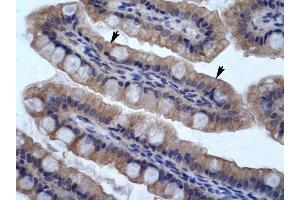 SMPDL3B antibody was used for immunohistochemistry at a concentration of 4-8 ug/ml to stain Epithelial cells of intestinal vilIus (arrows) in Human Intestine. (SMPDL3B Antikörper  (N-Term))