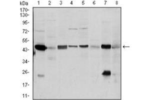 Western Blotting (WB) image for anti-Argininosuccinate Synthase 1 (ASS1) antibody (ABIN1105455) (ASS1 Antikörper)
