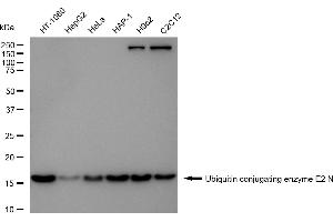 anti-Ubiquitin-Conjugating Enzyme E2N (UBE2N) antibody
