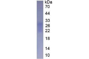 Image no. 2 for Fibronectin Type III Domain Containing 5 (FNDC5) (AA 32-143) (Active) protein (His tag) (ABIN6239745)