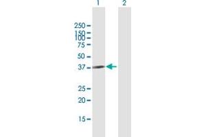 Western Blot analysis of CBX4 expression in transfected 293T cell line by CBX4 MaxPab polyclonal antibody. (CBX4 Antikörper  (AA 1-290))