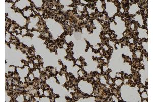 ABIN6274040 at 1/100 staining Mouse lung tissue by IHC-P. (PRC1 Antikörper  (Internal Region))