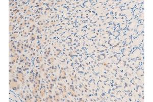 Immunohistochemistry (IHC) image for anti-Baculoviral IAP Repeat-Containing 5 (BIRC5) (pThr117) antibody (ABIN6255588)