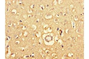 Immunohistochemistry of paraffin-embedded human brain tissue using ABIN7163908 at dilution of 1:100