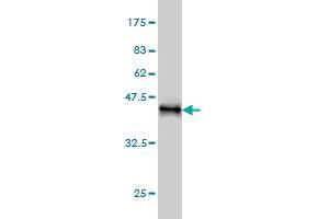 Western Blot detection against Immunogen (37. (KIF15 Antikörper  (AA 1279-1385))