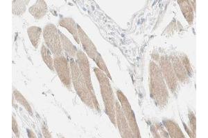 Immunohistochemistry (IHC) image for anti-NADH Dehydrogenase (Ubiquinone) 1, Subcomplex Unknown, 2, 14.5kDa (NDUFC2) (C-Term) antibody (ABIN6263556)