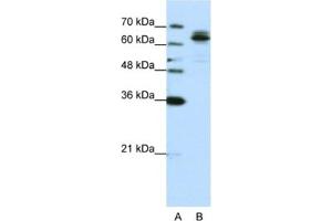 Western Blotting (WB) image for anti-Fragile X Mental Retardation, Autosomal Homolog 1 (FXR1) antibody (ABIN2462084)