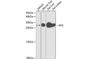 Western blot analysis of extracts of various cell lines using EPO Polyclonal Antibody at dilution of 1:500. (EPO Antikörper)