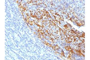 Formalin-fixed, paraffin-embedded human Tonsil stained with CD35 Mouse Monoclonal Antibody (To5). (CD35 Antikörper)