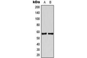 Western blot analysis of TBX22 expression in HeLa (A), Jurkat (B) whole cell lysates. (T-Box 22 Antikörper  (N-Term))
