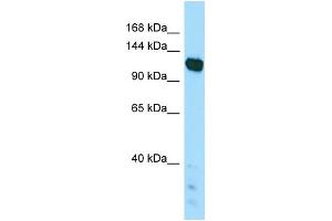 WB Suggested Anti-PAPLN Antibody Titration: 1. (PAPLN Antikörper  (C-Term))