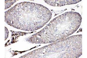 ADFP was detected in paraffin-embedded sections of mouse testis tissues using rabbit anti- ADFP Antigen Affinity purified polyclonal antibody (Catalog # ) at 1 µg/mL. (ADRP Antikörper  (AA 226-418))