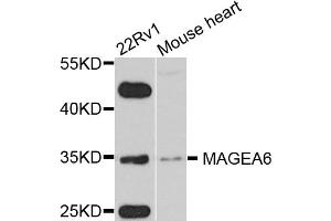 Western blot analysis of extracts of various cell lines, using MAGEA6 antibody. (MAGEA6 Antikörper)