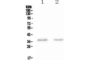 Western blot analysis of NCR1 using anti-NCR1 antibody . (NCR1 Antikörper  (AA 22-258))