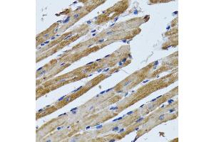 Immunohistochemistry of paraffin-embedded rat heart using ATP5B antibody (ABIN2561285) at dilution of 1:100 (40x lens).