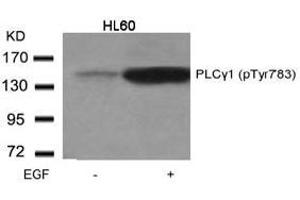 Image no. 1 for anti-phospholipase C, gamma 1 (PLCG1) (pTyr783) antibody (ABIN196792) (Phospholipase C gamma 1 Antikörper  (pTyr783))