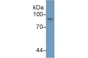 Detection of STAT4 in Human K562 cell lysate using Polyclonal Antibody to Signal Transducer And Activator Of Transcription 4 (STAT4) (STAT4 Antikörper  (AA 505-737))