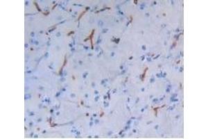 Detection of ALB in Mouse Brain Tissue using Polyclonal Antibody to Albumin (ALB) (Albumin Antikörper)