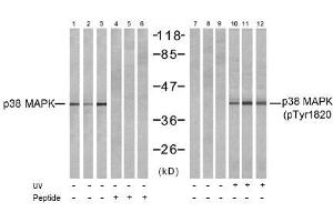 Image no. 1 for anti-Mitogen-Activated Protein Kinase 14 (MAPK14) (Tyr182) antibody (ABIN197496) (MAPK14 Antikörper  (Tyr182))