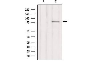 Western blot analysis of extracts from Hepg2, using RHG25 Antibody.