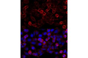 Immunofluorescence analysis of HeLa cells using HD antibody (ABIN6128054, ABIN6141681, ABIN6141684 and ABIN6215131) at dilution of 1:100 (40x lens). (HDAC6 Antikörper  (AA 836-1104))