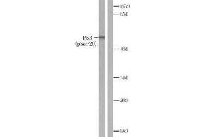 Western blot analysis of extracts from COS7 cells treated with (p53 Antikörper  (pSer20))