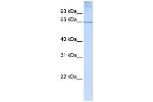 WB Suggested Anti-DLX4 Antibody Titration:  0.