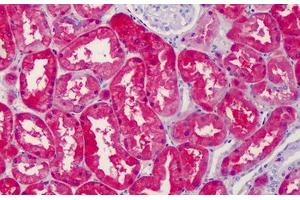 Human Kidney: Formalin-Fixed, Paraffin-Embedded (FFPE) (RAE1 Antikörper  (C-Term))