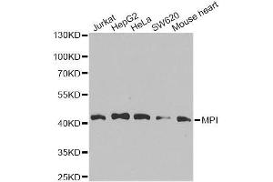 Western blot analysis of extracts of various cell lines, using MPI antibody. (MPI Antikörper  (AA 1-423))