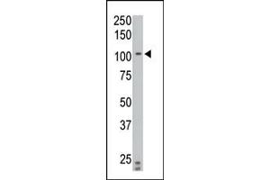 Western Blotting (WB) image for anti-Protein tyrosine Phosphatase, Receptor Type, N Polypeptide 2 (PTPRN2) (AA 94-125), (N-Term) antibody (ABIN392840)