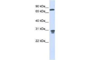 NIT2 antibody used at 1 ug/ml to detect target protein.