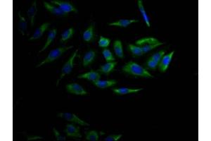 Immunofluorescence staining of Hela Cells with ABIN7127446 at 1:50, counter-stained with DAPI. (Rekombinanter CYP17A1 Antikörper)