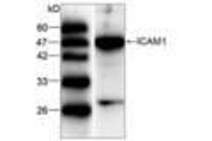 Image no. 1 for anti-Intercellular Adhesion Molecule 1 (ICAM1) (AA 301-532) antibody (ABIN791496) (ICAM1 Antikörper  (AA 301-532))