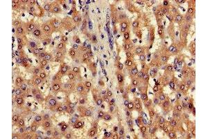 Immunohistochemistry of paraffin-embedded human liver tissue using ABIN7153223 at dilution of 1:100 (FUOM Antikörper  (AA 1-134))