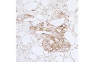 Immunohistochemistry (IHC) image for anti-Major Vault Protein (MVP) (AA 1-50) antibody (ABIN7455064) (MVP Antikörper  (AA 1-50))