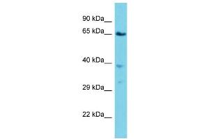 Host: Rabbit  Target Name: Vps45  Sample Tissue: Mouse Lung lysates  Antibody Dilution: 1.