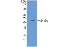 Western blot analysis of recombinant Human HAVCR2. (TIM3 Antikörper  (AA 22-202))