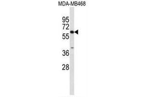 Western blot analysis of CES7 Antibody (Center) in MDA-MB468 cell line lysates (35µg/lane).