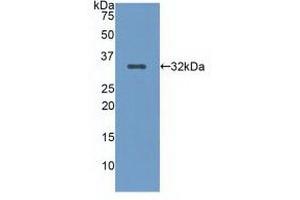 Detection of Recombinant LRP5, Human using Polyclonal Antibody to Low Density Lipoprotein Receptor Related Protein 5 (LRP5) (LRP5 Antikörper  (AA 769-1016))