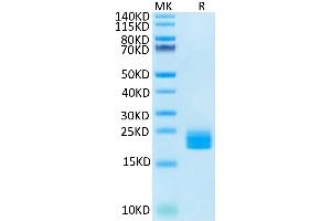 Huma LAIR2 on Tris-Bis PAGE under reduced condition. (LAIR2 Protein (AA 22-152) (His-Avi Tag))