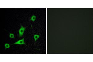 Peptide - +Immunohistochemistry analysis of paraffin-embedded human lung carcinoma tissue, using CRBP III antibody. (Retinol Binding Protein 5 Antikörper)