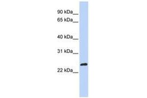 Image no. 1 for anti-MAX-Like Protein X (MLX) (AA 180-229) antibody (ABIN6744265) (MLX Antikörper  (AA 180-229))